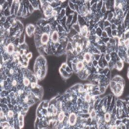JEG-3人绒毛膜癌细胞(提供STR鉴定报告)