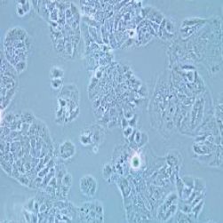 MDA-MB-415人乳腺癌细胞(提供STR鉴定报告)