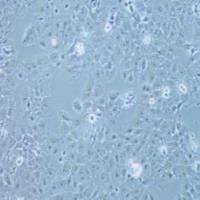 KYSE150人食管癌细胞(提供STR鉴定报告)