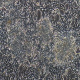 LNCaP clone FGC 人前列腺癌细胞(提供STR鉴定报告)