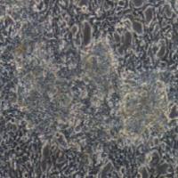 LNCaP clone FGC 人前列腺癌细胞(提供STR鉴定报告)