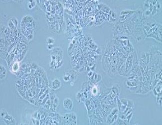 MDA-MB-415人乳腺癌细胞(提供STR鉴定报告)