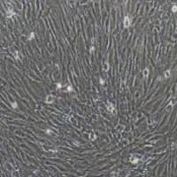 HSF(SV40转染) 人真皮成纤维细胞永生化