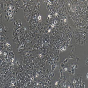 Ishikawa人子宫内膜癌细胞(提供STR鉴定报告)
