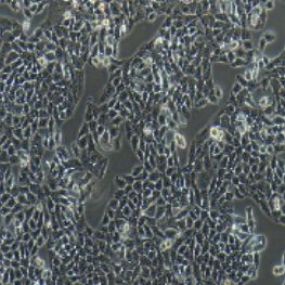 HT-29人结肠癌细胞(提供STR鉴定报告)