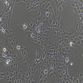 LX-2人肝星形细胞(提供STR鉴定报告)