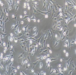 JF-305人胰腺癌细胞