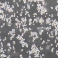 K562人慢性骨髓性白血病细胞系(提供STR鉴定报告)