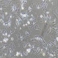 hTERT-HPNE人胰腺导管细胞(提供STR鉴定报告)