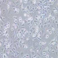 ME-180人子宫颈表皮癌细胞(提供STR鉴定报告)