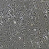 HUVEC+GFP人脐静脉内皮细胞永生化+GFP