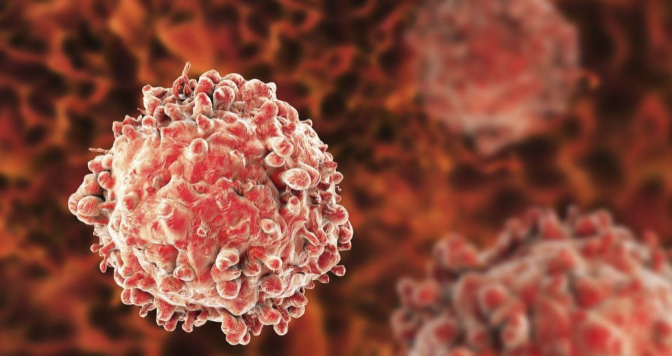 Cytek推出一管20色急性髓系白血病分析试剂盒，一站式解决方案帮助提升工作效率，推进新型AML治疗方案的开发