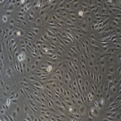 HUVEC+RFP人脐静脉内皮细胞永生化+RFP