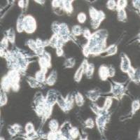 MDA-MB-436人乳腺癌细胞(提供STR鉴定报告)