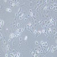 KLE人子宫内膜癌细胞(提供STR鉴定报告)