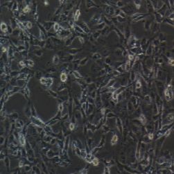 MET-5A人膜间皮细胞(提供STR鉴定报告)