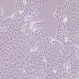 MKN-74人胃癌细胞
