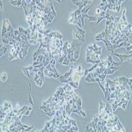 NCI-H295R人肾上腺皮质腺癌细胞(提供STR鉴定报告)