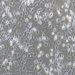 MUM2B人侵袭性脉络膜黑色素瘤细胞(提供STR鉴定报告)