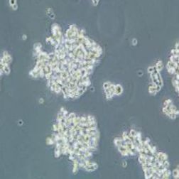 NCI-H82人小细胞肺癌细胞(提供STR鉴定报告)