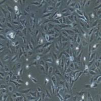 NCI-H446人小细胞肺癌细胞(提供STR鉴定报告)