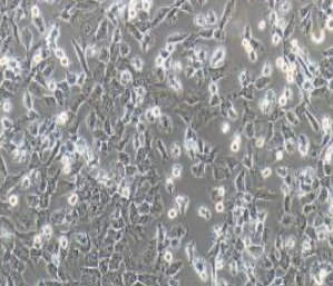 MUM2B人侵袭性脉络膜黑色素瘤细胞(提供STR鉴定报告)