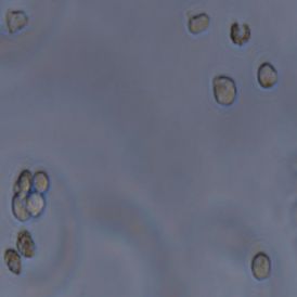 MOLT-4人急性淋巴母细胞性白血病细胞