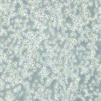 MM.1S人多发性骨髓瘤细胞(提供STR鉴定报告)