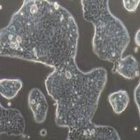 NCI-N87+luc人胃癌细胞荧光素酶标记