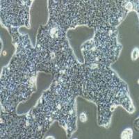 NCI-N87人胃癌细胞(提供STR鉴定报告)