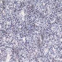 P53R人结直肠癌细胞(提供STR鉴定报告)