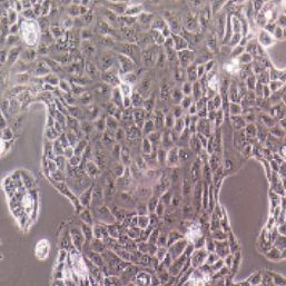 PANC 05.04人胰腺癌细胞(提供STR鉴定报告)