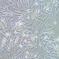 OCM1A人眼脉络黑色素瘤细胞(提供STR鉴定报告)