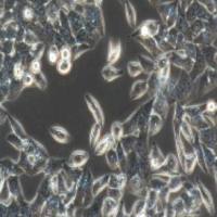 OVCAR-3人卵巢腺癌细胞(提供STR鉴定报告)