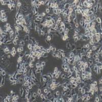 NOZ人胆囊癌细胞(提供STR鉴定报告)