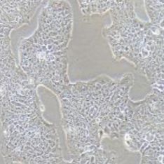 RT4人膀胱移行细胞乳头瘤(提供STR鉴定报告)