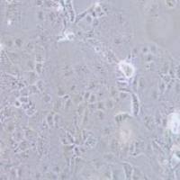 PLC-PRF-5人肝癌亚力山大细胞(提供STR鉴定报告)