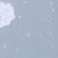 SHP-77人小细胞肺癌细胞(提供STR鉴定报告)