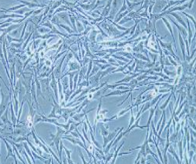 SK-MEL-28人恶性黑色素瘤细胞(提供STR鉴定报告)