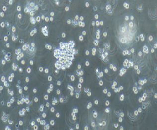 Raji人淋巴瘤细胞(提供STR鉴定报告)