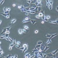 SCC-9人类鳞状上皮舌癌细胞(提供STR鉴定报告)