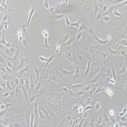 SK-OV-3人卵巢癌细胞(提供STR鉴定报告)