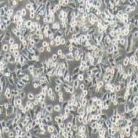 PATU 8988t人胰腺癌细胞(提供STR鉴定报告)