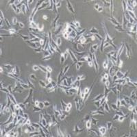 SK-MEL-2+luc 人皮肤黑色素瘤细胞+luc