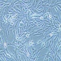 SK-MEL-28人恶性黑色素瘤细胞(提供STR鉴定报告)
