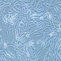 SK-MEL-28人恶性黑色素瘤细胞(提供STR鉴定报告)