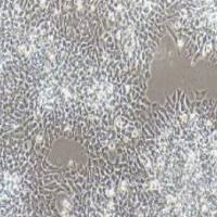 SK-N-MC人神经上皮瘤细胞