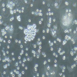 Raji人淋巴瘤细胞(提供STR鉴定报告)