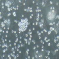 Raji人淋巴瘤细胞(提供STR鉴定报告)