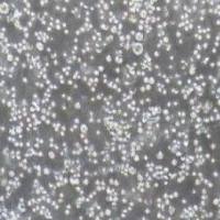 RPMI8226人多发性骨髓瘤外周血B淋巴细胞(提供STR鉴定报告)